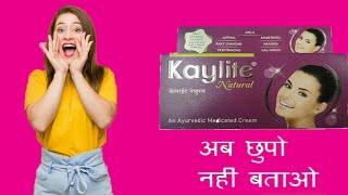 Kaylite Ayurveda Natural Face Cream  kaylite cream review  kaylite cream uses in hindi [upl. by Chatterjee]