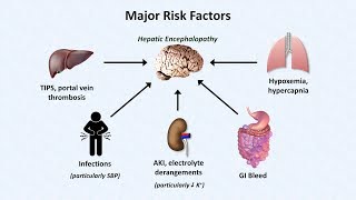 Hepatic Encephalopathy [upl. by Anerac964]