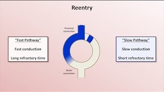 Intro to EKG Interpretation  Mechanisms of Tachyarrhythmias [upl. by Wilmette]