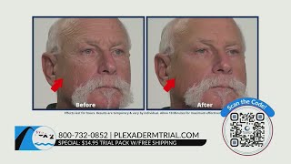 Plexaderm will get your complexion ready for summer – get a special deal for Memorial Day [upl. by Bridwell]