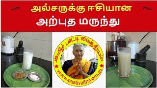 அல்சருக்கு ஈசியான அற்புத மருந்து Simple Remedy for Ulcer [upl. by Llerrit912]