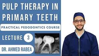 Lecture 03  Pulp Therapy in Primary Teeth  Pulpotomy vs Pulpectomy  كورس بيدو عملي [upl. by Adali]