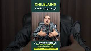 What are the danger signs of chilblains  چلبلینز کے خطرے کی علامات؟  Dr Tanveer Arshad Ch [upl. by Eelyac57]