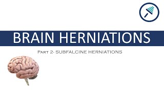 BRAIN HERNIATIONS 24 Subfalcine Herniations [upl. by Ociredef]