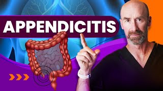 Appendicitis When SHOULD I Go To The Doctor [upl. by Ilojna]