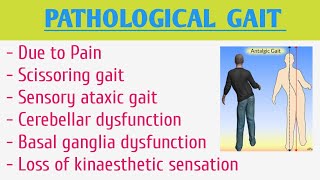 Pathological Gait [upl. by Kaja259]