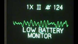 ACLS Algorithms  Ventricular Fibrillation  Sacramento Class [upl. by Tucky]