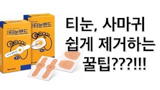 티눈 사마귀 쉽게 제거 하는 꿀팁 병원가서 냉동 레이저 치료 전에 시도 해보세요 [upl. by Oned924]