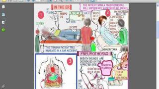 SESSIONS for NURSES 8  TRAUMA  CHEST ABDOMINAL and SPINAL [upl. by Charlean]