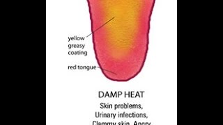 Chinese Medicine Damp Heat [upl. by Malkin423]