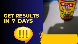 PT 2 Great results in 7 days  Continuing apple cider vinegar benefits [upl. by Oirelav]