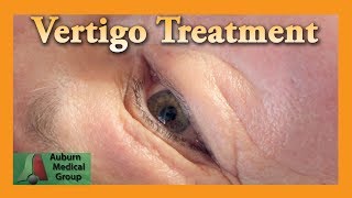 Vertigo Treatment  Auburn Medical Group [upl. by Eaned917]