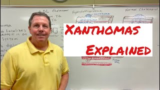 Xanthoma A Simple Explanation [upl. by Aisila]