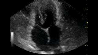 echocardiography feline peritoneopericardial diaphragmatic hernia [upl. by Nyrek]