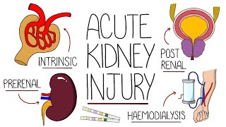 Acute kidney Injury [upl. by Prussian764]