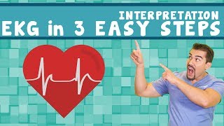 EKG interpretation  PQRST memory Trick  in 3 easy steps Part 2 [upl. by Avin591]