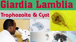 Giardia Lamblia Cyst amp Trophozoite [upl. by Annaul]