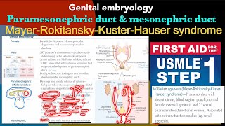 Genital embryology Male amp Female development ￼ Mullerian agenesis in HindiUrdu by USMLE step 1 [upl. by Shelby]