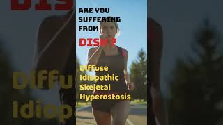 DISH  Diffuse Idiopathic Skeletal Hyperostosis  Physiotherapy at Home  Neo Physio [upl. by Iegres]