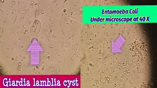 Difference between Giardia Lamblia amp Entamoeba Coli cystBest view under microscope at 40 X [upl. by Bennie]