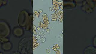 White blood cells fighting infection under microscope like subscribe shorts [upl. by Eta]