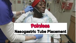 Painless Nasogastric Tube Placement [upl. by Eerolam249]