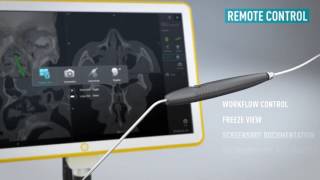 Kick® EM for ENT—Electromagnetic Navigation for Sinus Surgery [upl. by Lelia]