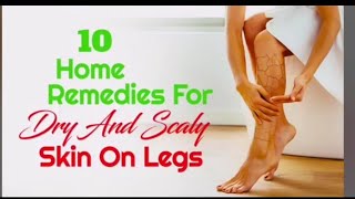 10 HOME REMEDIES FOR DRY and SCALY SKIN ON LEGS  HEALTHY LIFESTYLE [upl. by Edylc466]