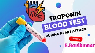 What is a Troponin test in Telugu  How is the tropt test done  Why do you do it  BRavikumar [upl. by Lukasz175]