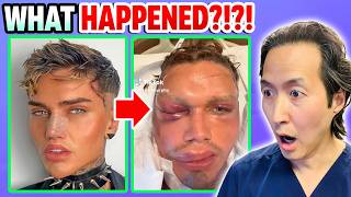 5 Plastic Surgeries on 1 Day That Went HORRIBLY Wrong [upl. by Leimaj]