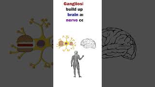 TaySachs Disease  Easy to remember Animation of Lysosomal Disorder shorts short medical [upl. by Shore]