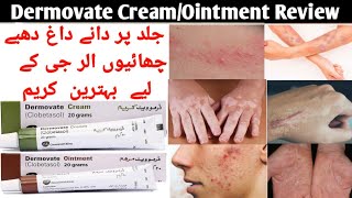 Dermovate Cream Uses Dermovate ointment Uses Clobetasol Cream Uses and Side effects in Urdu Hindi [upl. by Inaffets506]