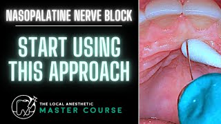 How to Do A Nasopalatine Nerve Block  Online Dental Continuing Education  LocalAnestheticcom [upl. by Eanil]