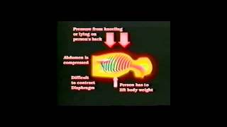 Positional Asphyxia [upl. by Hafital]