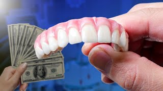 Full Mouth Dental Implants Cost and Comparison [upl. by Zigmund]