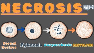 “Nuclear Metamorphosis Exploring Pyknosis Karyorrhexis and Karyolysis” Necrosis part 2 [upl. by Lionello42]