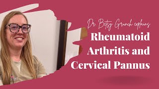 Case study 41  Rheumatoid Arthritis and Cervical Pannus explained by boardcertified neurosurgeon [upl. by Harak]