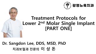 Treatment Protocols for Lower 2nd Molar Single Implant PART 1 [upl. by Torry99]