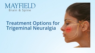 Facial Pain Treatment Treatment Options for Trigeminal Neuralgia [upl. by Anelav]