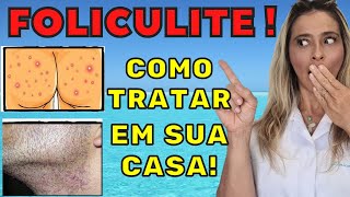 FOLICULITE COMO ELIMINAR AQUELAS BOLINHAS VERMELHAS DO BUMBUM BARBA VIRILHA COM RECEITA CASEIRA [upl. by Jori]