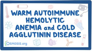 Warm autoimmune hemolytic anemia and cold agglutinin NORD [upl. by Nageem321]