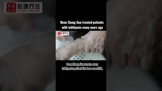 Dean Zhang Jian treated patients with ichthyosis many years ago ichthyosis skincare dryskin [upl. by Akemahc]