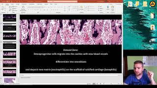 Histology of the Ossification part 2 [upl. by Barger610]