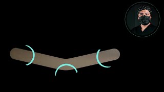 How to modify tofflemire matrices for dental composite veneers [upl. by Trepur]