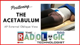 How to Xray amp Position the Acetabulum AP External Oblique [upl. by Aeslehs5]