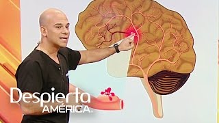 ¿Cómo detectar las señales de un aneurisma cerebral [upl. by Yeliab]