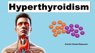 Hyperthyroidism تضخم الغدة الدرقية  hyperthyroidism thyroidmanagement thyroidhormone [upl. by Blase685]