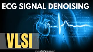 Signal Processing Projects  ECG Signal Denoising  Digital Signal Processing  FPGA [upl. by Almira]