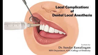 Local Complications of Dental Local Anesthesia [upl. by Oinegue317]