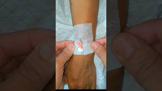 IV Cannulation subscribe cannula ivcannula health shortsindia [upl. by Ainival907]